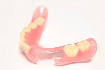 ノンクラスプデンチャー