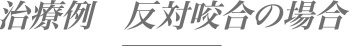 治療例　反対咬合の場合