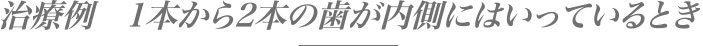 治療例　1本から2本の歯が内側にはいっているとき