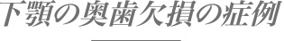 下顎の奥歯欠損の症例