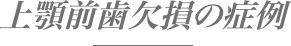 上顎前歯欠損の症例