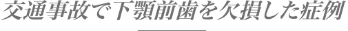 交通事故で下顎前歯を欠損した症例